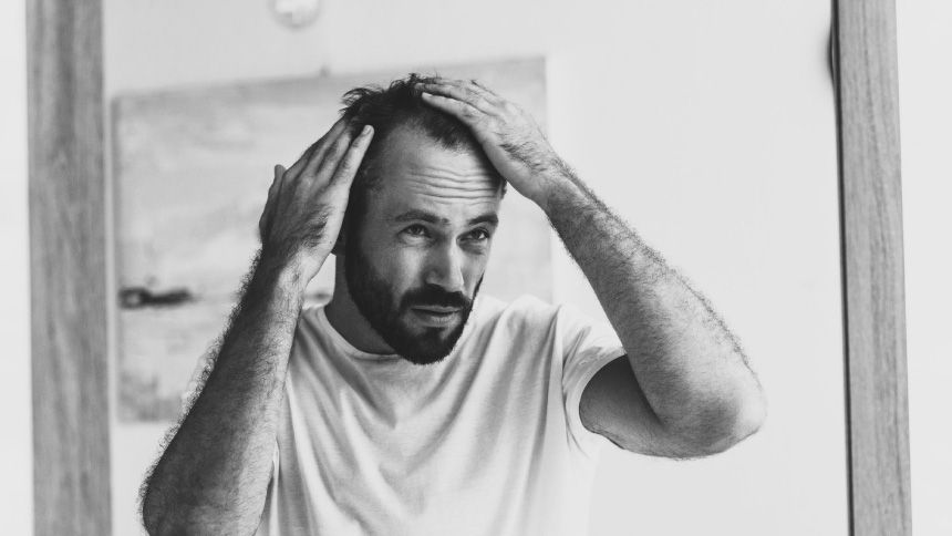 Male Hair Loss Treatment - 30% Carers discount on your 1st order